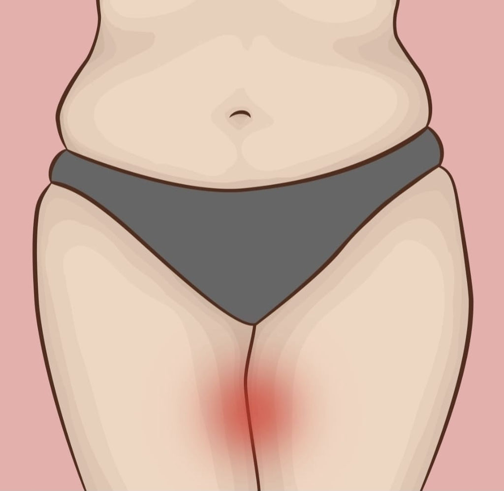 Dites adieu aux irritations entre les cuisses — Invisible, efficace toute la journée